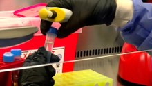 Los peligros del hantavirus de los Andes: "Es la única cepa del mundo que se contagia entre personas"