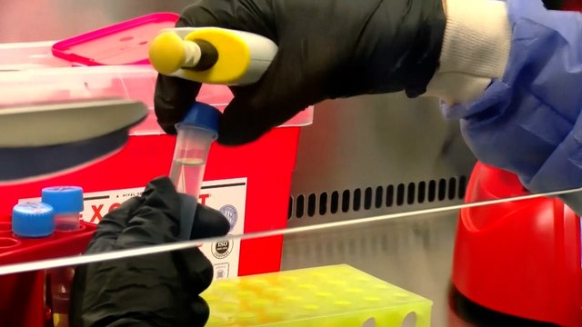 Los peligros del hantavirus de los Andes: Es la única cepa del mundo que se contagia entre personas