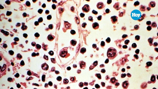 Hantavirus: qué es, cómo se contagia, situación en RD, prevención y por qué no sería otro covid-19