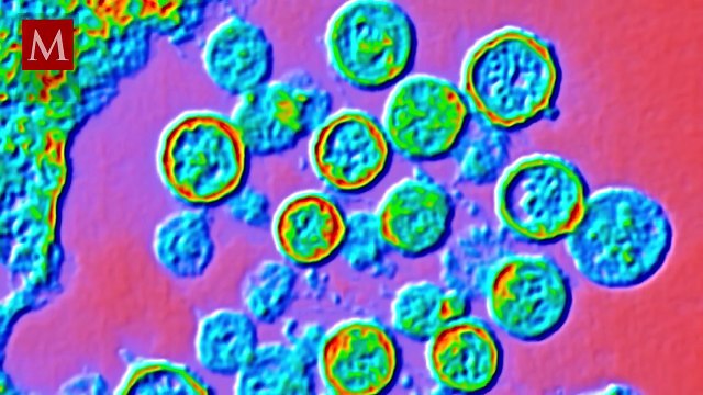 ¿Otra pandemia? Científicos revelan la verdad: Hantavirus vs. Covid-19