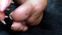 Garlic saves the day for this spot in feet