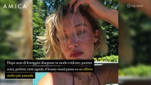 Lentiggini sì, ma soft: come portarle senza effetto finto