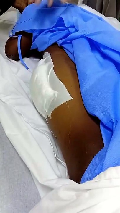 Niño que cayó desde elevado en Los Alcarrizos e...
