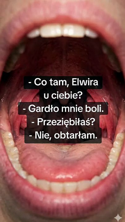 Rana #ból #ciało #przyjaciółki #humor #sarcastichumor
