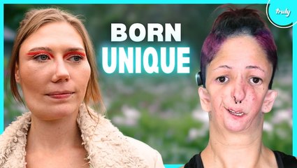 Meet 8 Of The Rarest People In The World | BORN DIFFERENT