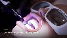 Des dents blanches... au rire jaune ! Bande-annonce (FR)