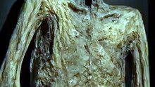 Mummy of Egyptian
