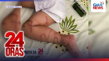 Abangan sa #24Oras — 4-anyos, nag-agaw buhay nang madikitan ng dikya! | 24 Oras