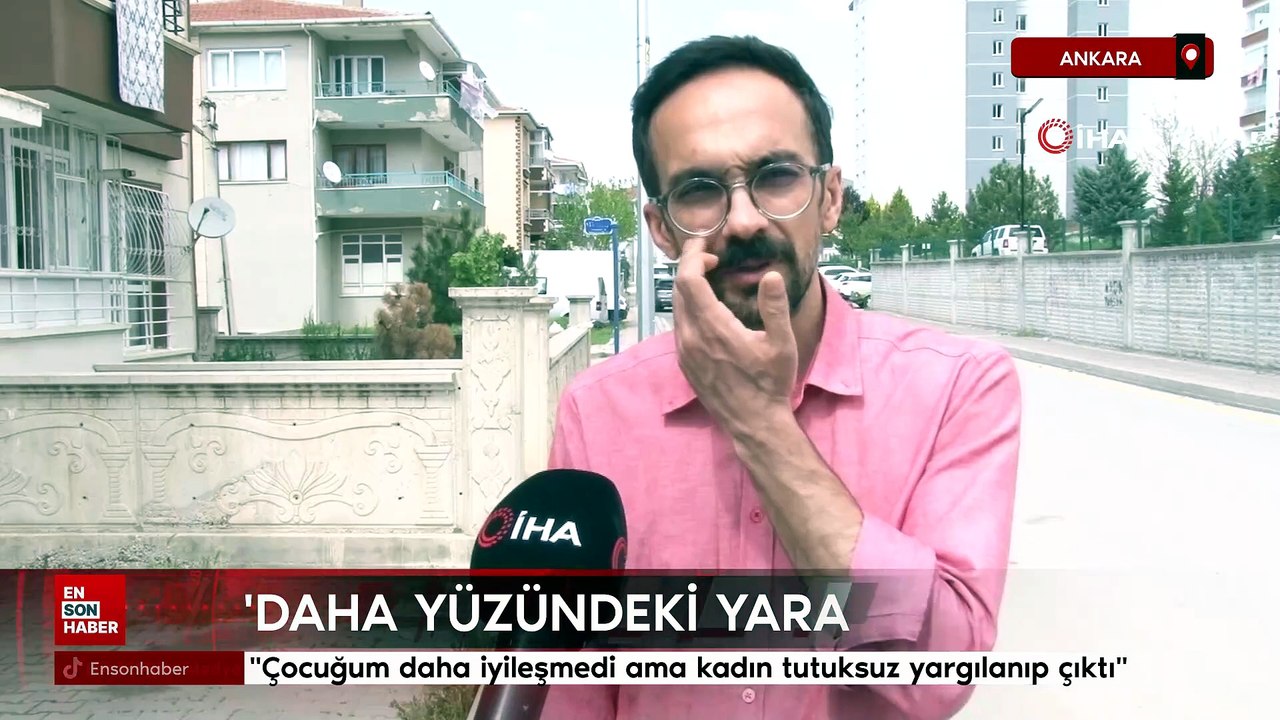 Ankara'da iki çocuğu pitbull saldırısına uğrayan baba konuştu