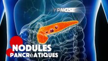 Nodules pancréatiques
