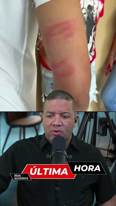 😱 Delivery asegura que policías lo golpearon tras persecución