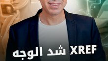 "XREF" أفضل تقنية لشد الوجه بدون جراحة وآلم