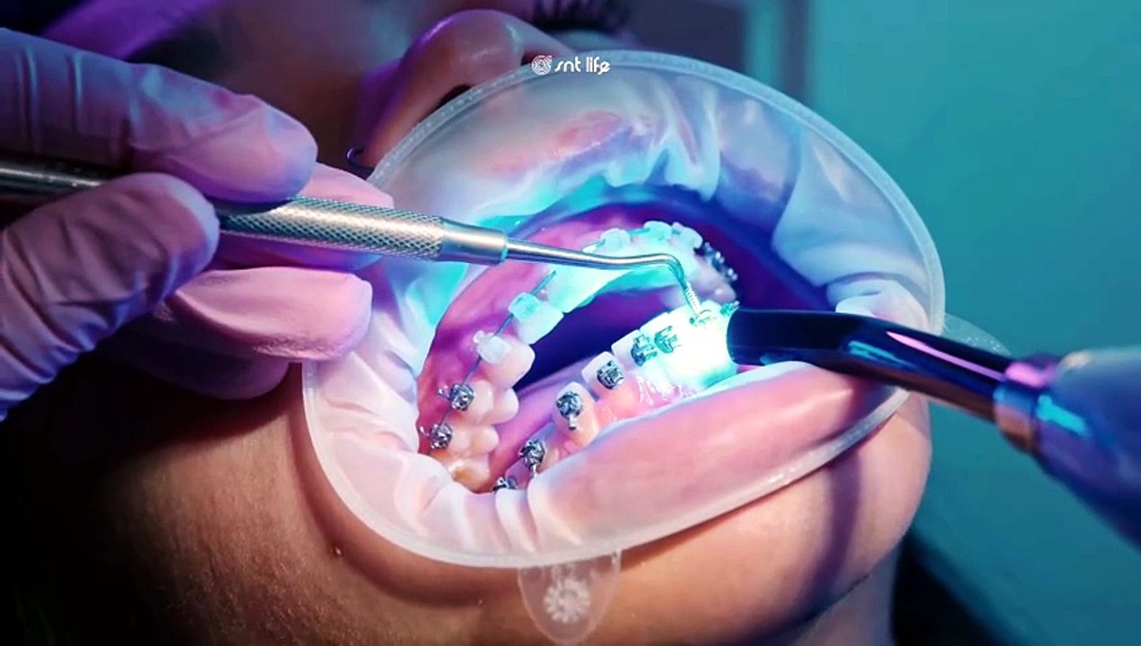 Rüyada Diş Yaptırmak Ne Anlama Gelir?