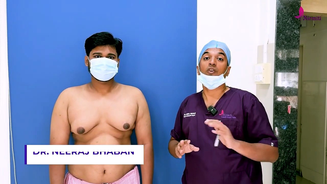 Gynecomastia Surgery