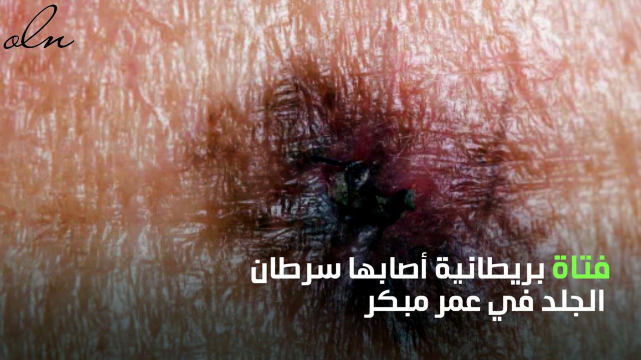 خطأ ارتكتبه والدتها اصابها بالسرطان وقتلها، تعر...
