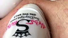 Blackheads Removal #5