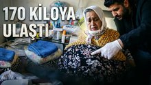Karnındaki Dev Kitleyle 15 Yıldır Yaşam Mücadelesi Veriyor