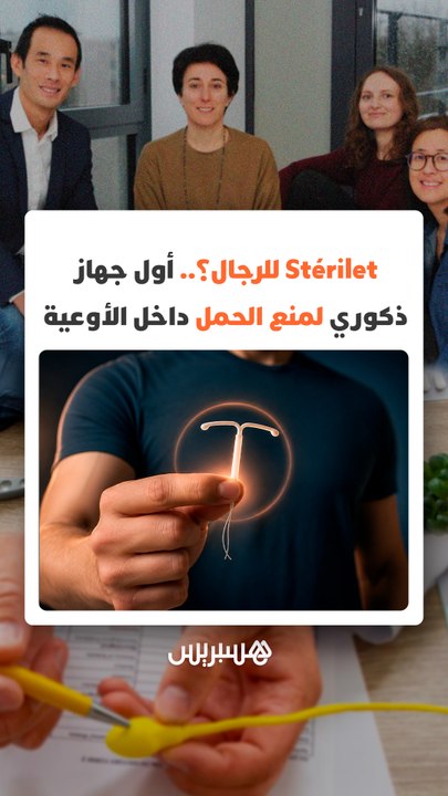 Stérilet للرجال؟.. أول جهاز ذكوري لمنع الحمل داخل الأوعية يستعد للاختبارات البشرية