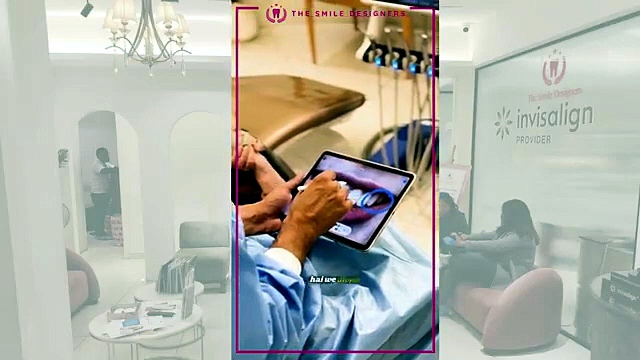Dental Veneers Process Step by Step - Complete Smile Makeover