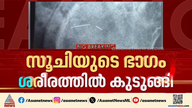 സൂചിയുടെ ഭാഗം ശരീരത്തിൽ കുടുങ്ങി; ആശുപത്രിക്കെതിരെ ചികിത്സാ പിഴവ് ആരോപിച്ച് വീട്ടമ്മ| Kozhencherry