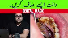 The #1 Top Remedy for Dental Plaque (TARTAR) | Dr. Zee | डॉक्टर ज़ी