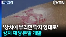 '상처에 뿌리면 딱지 형태로 변한다'...상처 재생 분말 개발 / YTN