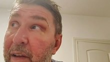 El dramático accidente de Emiliano Pinsón en plena lucha contra el Parkinson