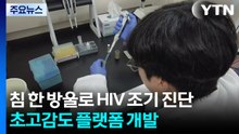 침 한 방울로 HIV 조기 진단...초고감도 플랫폼 개발 / YTN