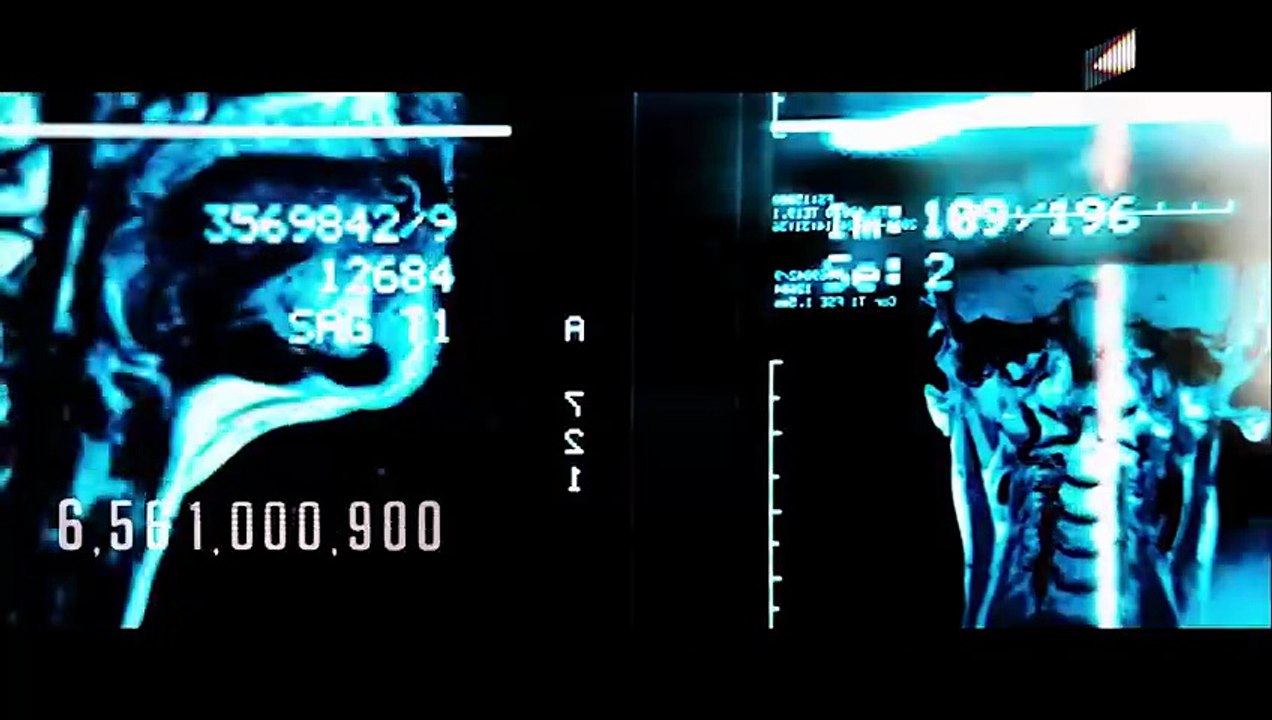 Patient Zero (Full Movie) _ Starring Matt Smith_ Natalie Dormer _ John Bradley(480P)