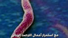 هل رصدت مصر حالات إصابة بـ"الإيبولا"؟.. مستشار رئيس الجمهورية للشؤون الصحية يجيب