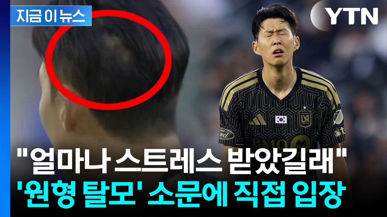 팬들 놀란 '원형 탈모' 논란에...손흥민이 직접 올린 사진 [지금이뉴스] / YTN