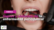 Signos y síntomas de la enfermedad periodontal