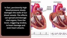 Don't Get It Wrong! 5 Hypertension Myths That Could Threaten Your Life