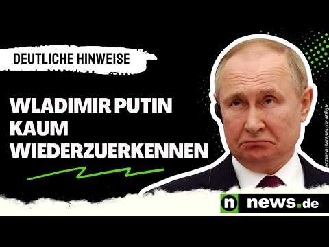 Wladimir Putin kaum wiederzuerkennen: Kremlchef unter dem Messer? Ärztin sieht deutliche Hinweise