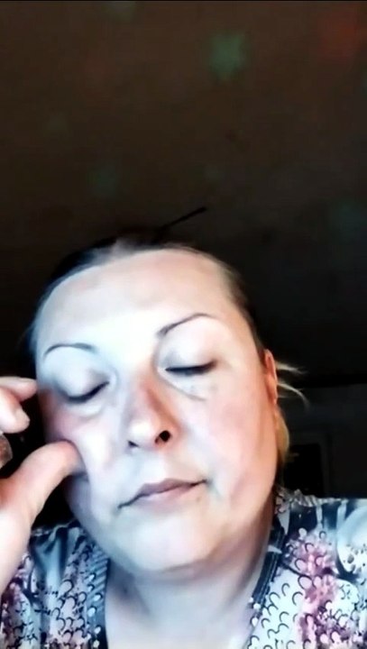 GENITALNI HERPES IZ ZAKLOPLJAČKE_HD