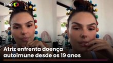Isis Valverde revela três internações neste ano devido à doença celíaca: ‘É traumatizante’