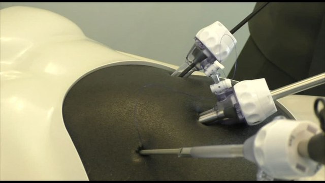 Tecnologia e innovazione: come cambia la chirurgia mini-invasiva
