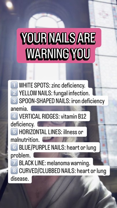 YOUR NAILS ARE WARNING YOU