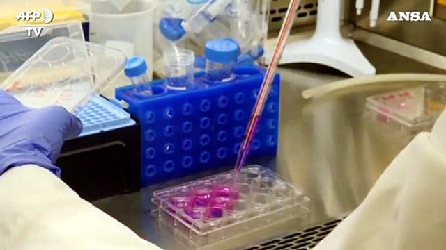 Da Italia nuova arma contro sindrome Down e autismo