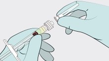 Mynzepli : procédure d'injection intravitréenne pour le traitement des patients adultes