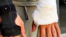 Un jeune garçon se fait plâtrer… mais du mauvais bras
