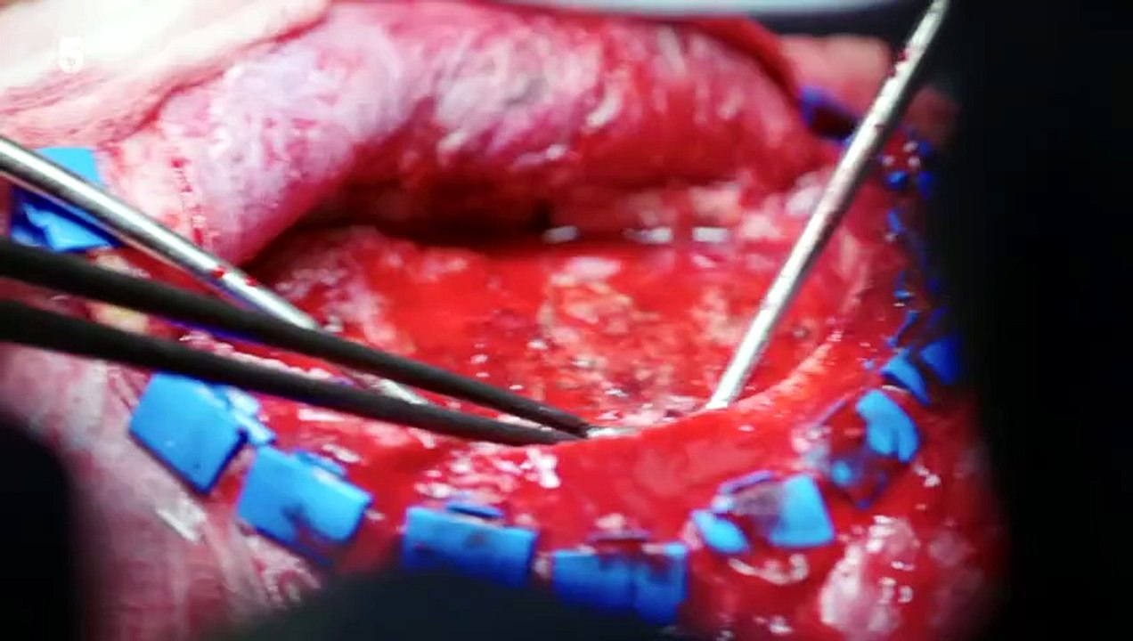 Trauma Room One S02E05