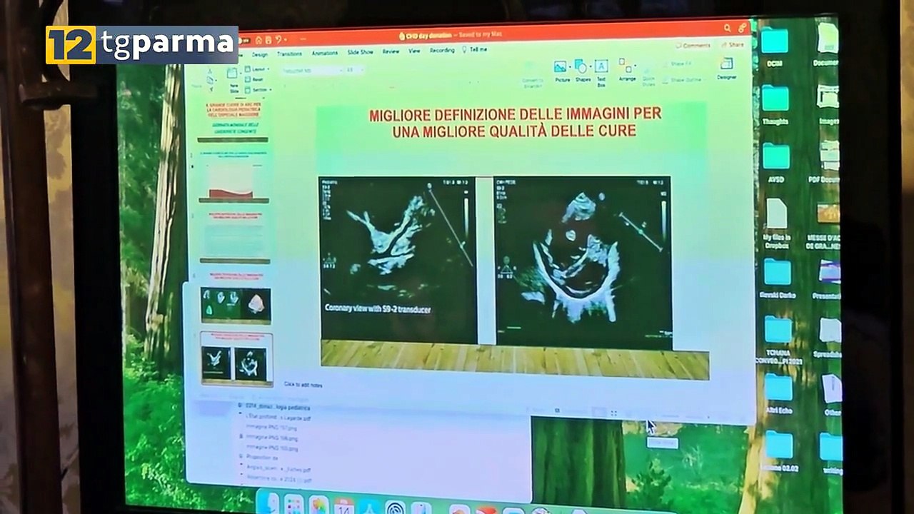 ASSOCIAZIONE "ABC": DONAZIONE ALLA CARDIOLOGIA PEDIATRICA DEL MAGGIORE | ASSOCIAZIONE "ABC": DONAZIONE ALLA CARDIOLOGIA PEDIATRICA DEL MAGGIORE