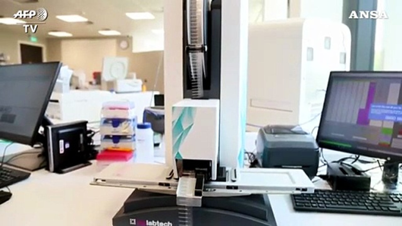 Vaccino Oxford accelera, a dicembre 100 milioni dosi