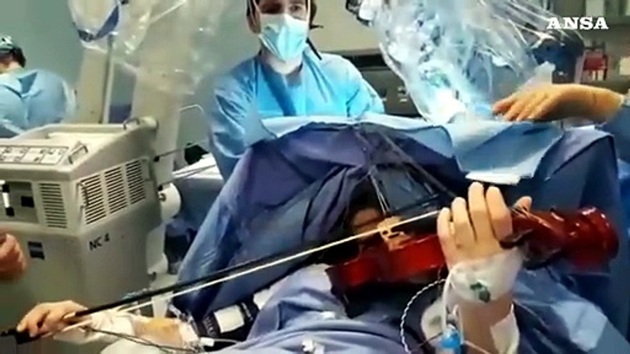 Operata di tumore al cervello mentre suona il violino