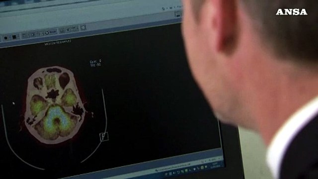 Riattivate cellule cervello di maiale ore dopo la morte