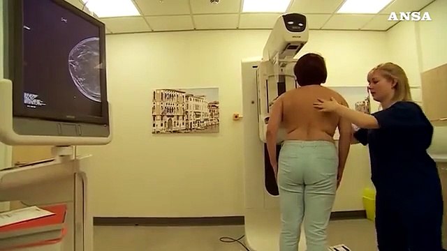 Tumore seno, nuova cura aumenta sopravivenza giovani