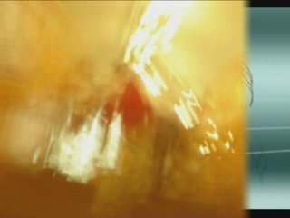 Besoin d'amour - France Gall