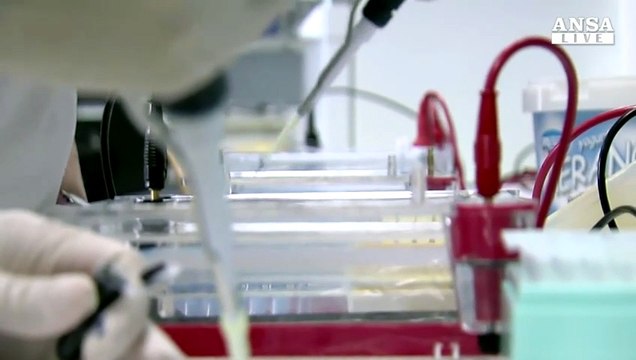 Da tumore seno a polmone, nuova arma immunoterapia
