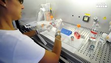 Leucemia mieloide acuta, un test sangue per predirla